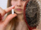 hair loss treatments