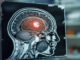 primary brain tumors
