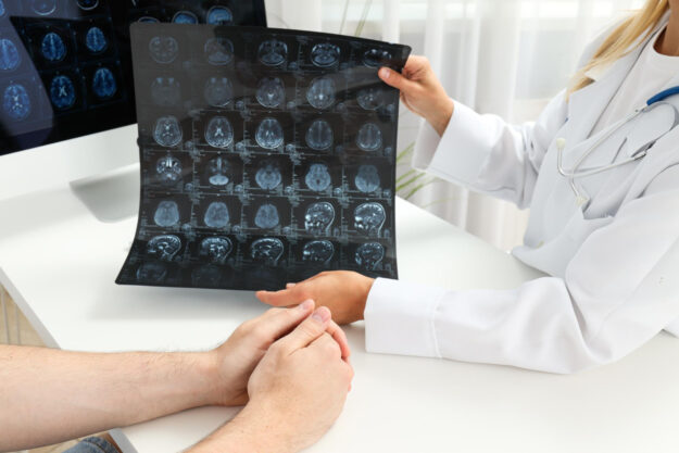 chemotherapy and radiation for brain tumors