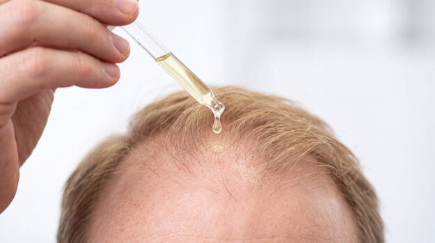 hair growth treatments