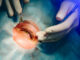 LASIK Eye Surgery: What to expect before, during, and after the procedure