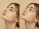 Rhinoplasty Recovery: What to Expect Week by Week After Nose Surgery