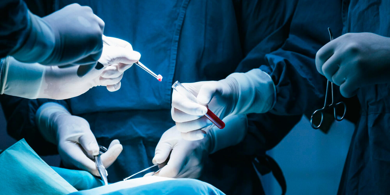 χειρουργείο βουβωνοκήλης σε γυναίκα χειρουργείο βουβωνοκήλης σε γυναίκα